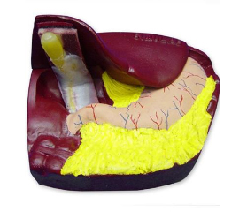 Cholecystectomy Model (LC-10)